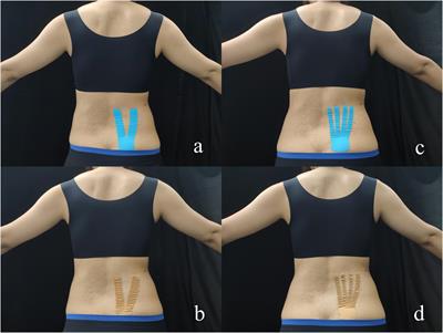 Short-Term Effect of Different Taping Methods on Local Skin Temperature in Healthy Adults